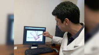 FCecon faz cirurgia inédita na rede pública para tratar câncer de colo uterino
