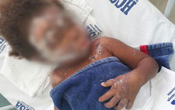 Polícia de Roraima prende suspeito de atear fogo em família venezuelana
