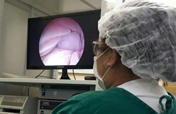 FCecon aumenta número de procedimentos de endoscopia no primeiro trimestre de 2018
