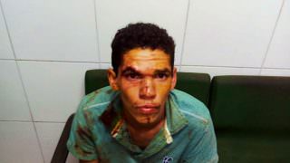 Homem esfaqueia a mãe grávida, mata cachorro da família e come o coração do animal