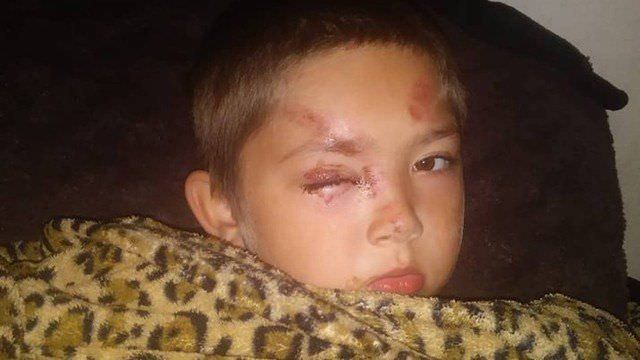 Menino de 6 anos defende amigo vítima de bullying e é atacado por 7 crianças