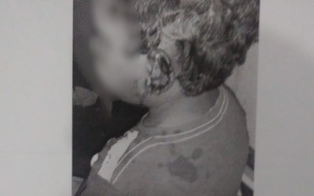 Padrasto é preso e confessa ter agredido e cortado orelha de enteado de 4 anos