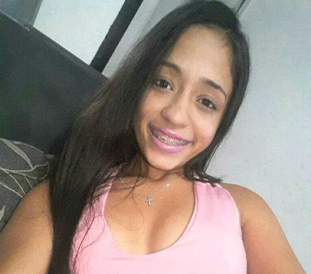 Jovem é baleada na cabeça na frente do namorado; dupla fugiu em moto