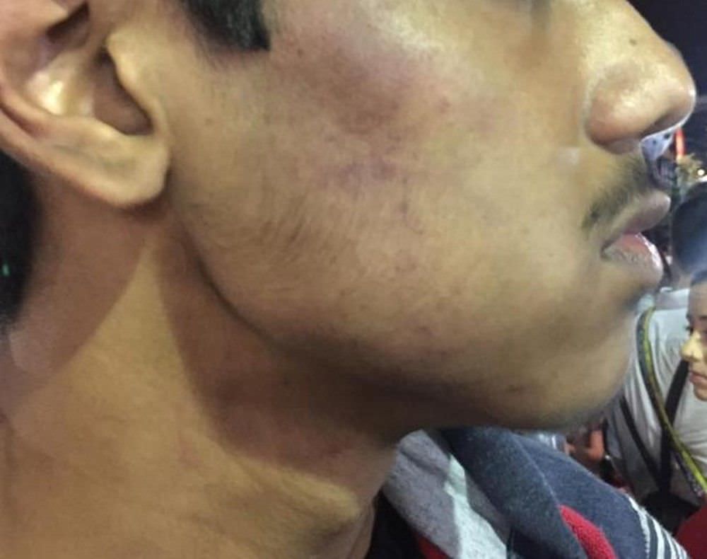 Intercambista de 16 anos é confundido com suspeito de furto e sofre agressão