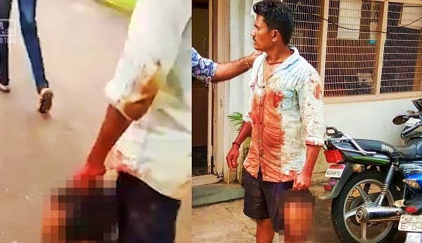 Homem caminha segurando a cabeça decepada do amigo depois que ele “passou a mão na sua mãe”