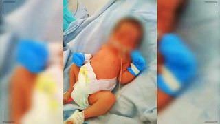 Bebê prematuro de 7 meses morre em hospital após receber leite na veia