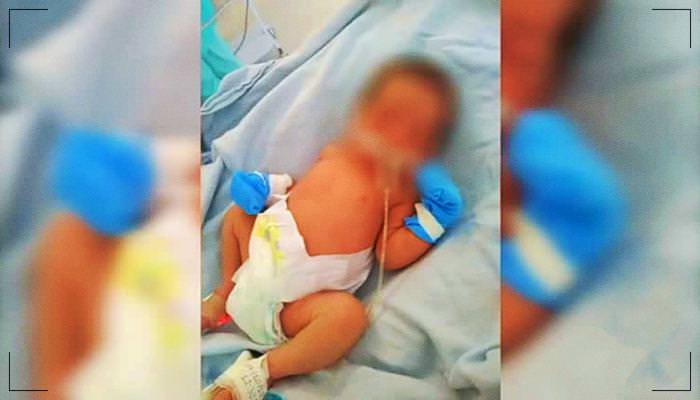Bebê prematuro de 7 meses morre em hospital após receber leite na veia