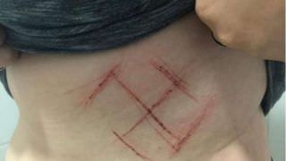 Trio faz suástica em barriga de jovem que vestia camiseta com 'Ele Não'