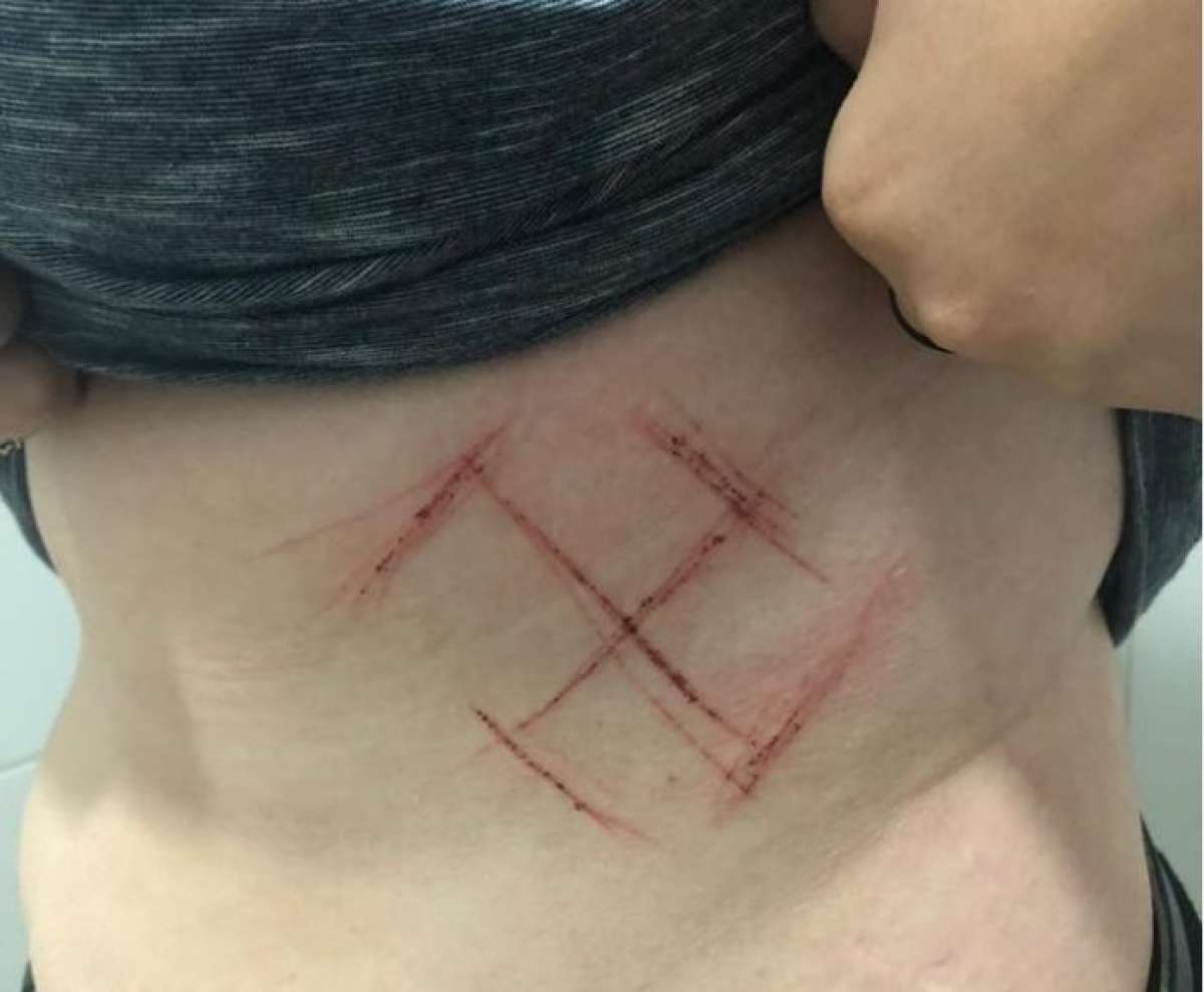 Trio faz suástica em barriga de jovem que vestia camiseta com 'Ele Não'