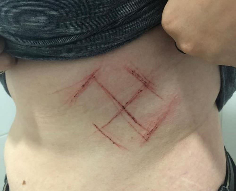 Jovem que diz ter sido marcada com suástica na barriga é indiciada por falsa comunicação de crime