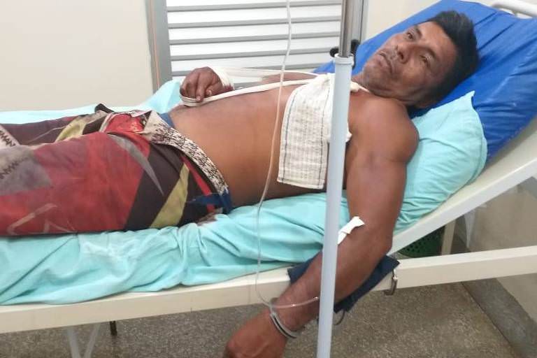 Índio é baleado após confronto com policiais e barco de pesca no AM