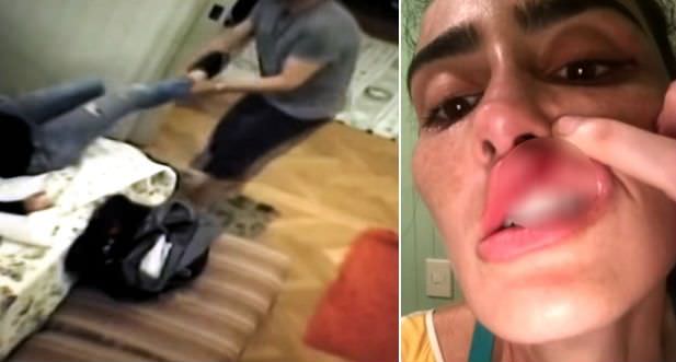 Atriz global esconde câmeras em casa e grava agressões do marido; assista