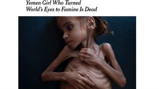 Aos 7 anos, morre menina símbolo da fome causada por guerra