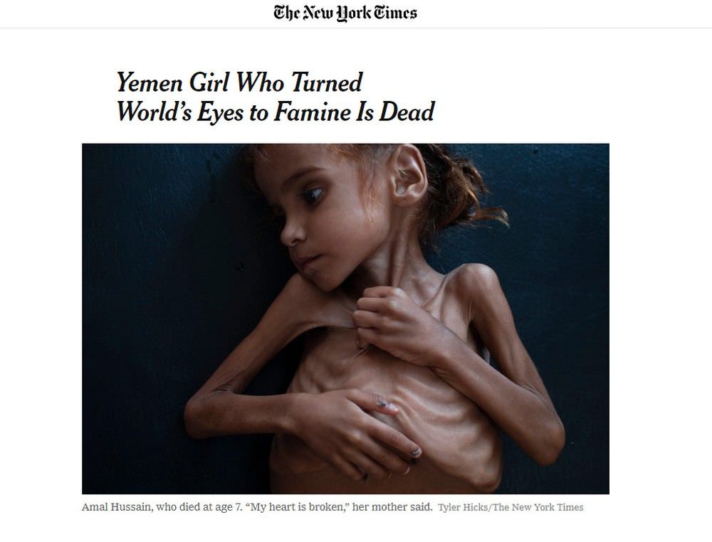 Aos 7 anos, morre menina símbolo da fome causada por guerra