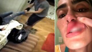 Atriz global esconde câmeras em casa e grava agressões do marido; assista