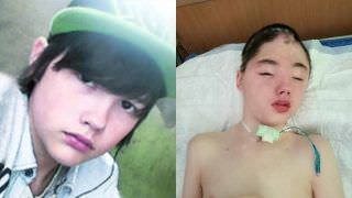 Morre adolescente que perdeu parte do crânio ao tentar salvar a mãe de estupro