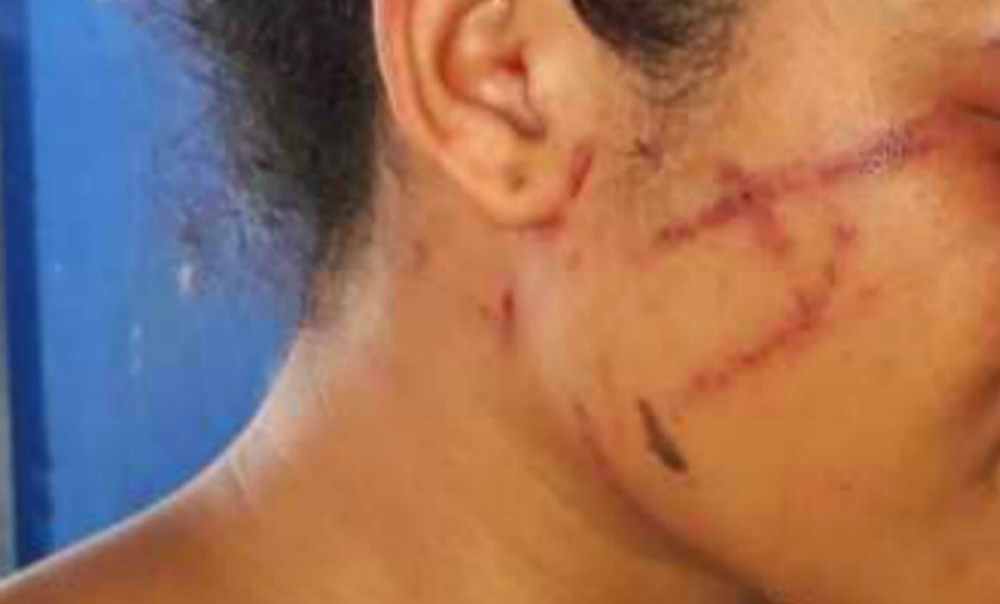 Menina de 13 anos é agredida e ameaçada de morte por ex-namorado