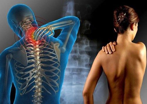 SUS vai oferecer medicamento para pacientes com esclerose múltipla