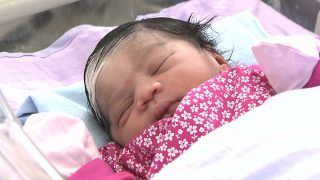 Primeiro bebê de 2019 nasce com franja branca por condição genética