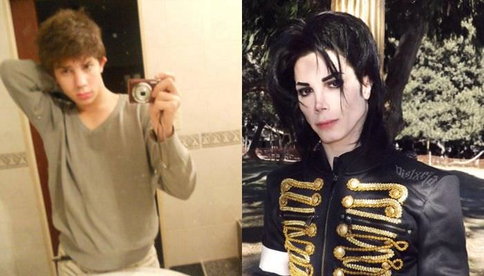 Fã argentino gasta R$ 110 mil em plásticas para parecer Michael Jackson