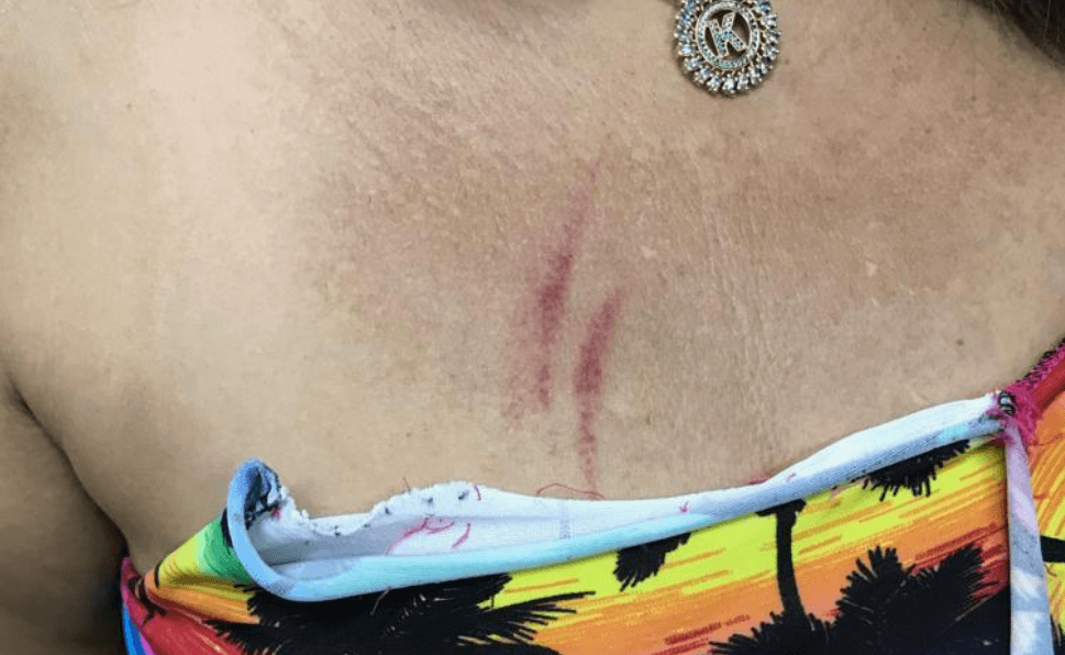 Jovem luta contra homem para não ser estuprada em salão de Manaus