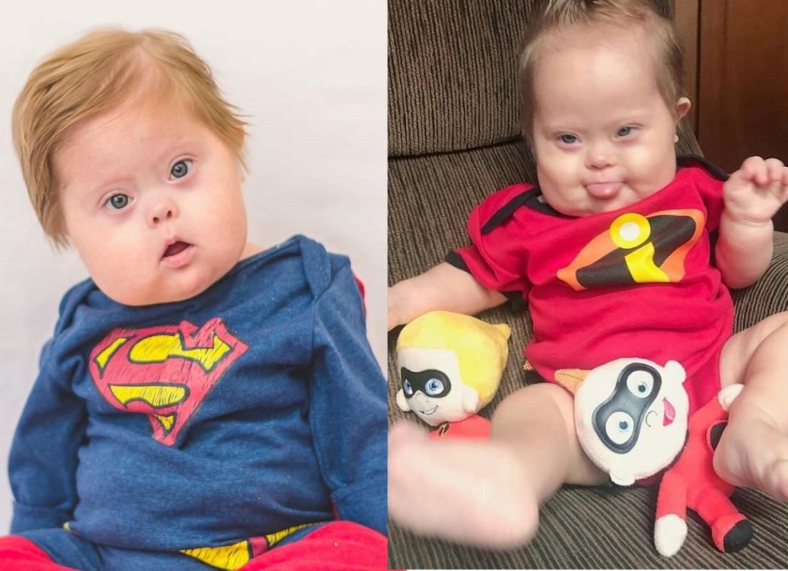 Super Chico: Bebê com Síndrome de Down viraliza na web com fantasias de heróis