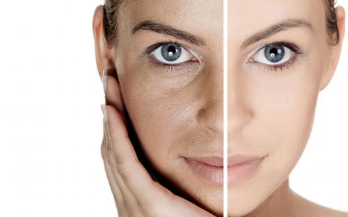 Conheça 7 hábitos que pioram a oleosidade da pele