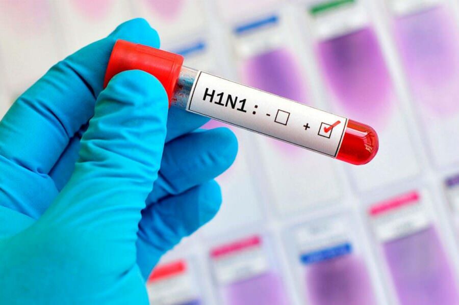 Amazonas já registra quatro mortes por influenza H1N1 em 2023