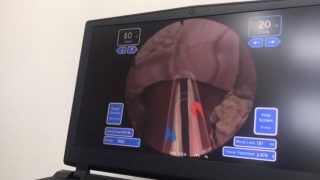 Cirurgia robótica e videolaparoscopia ganham espaço na urologia