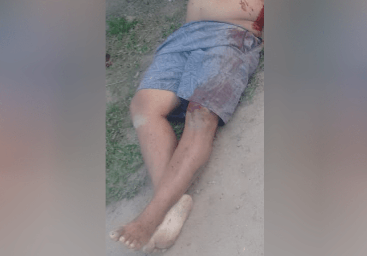Homem é encontrado decapitado em praia de Angra dos Reis