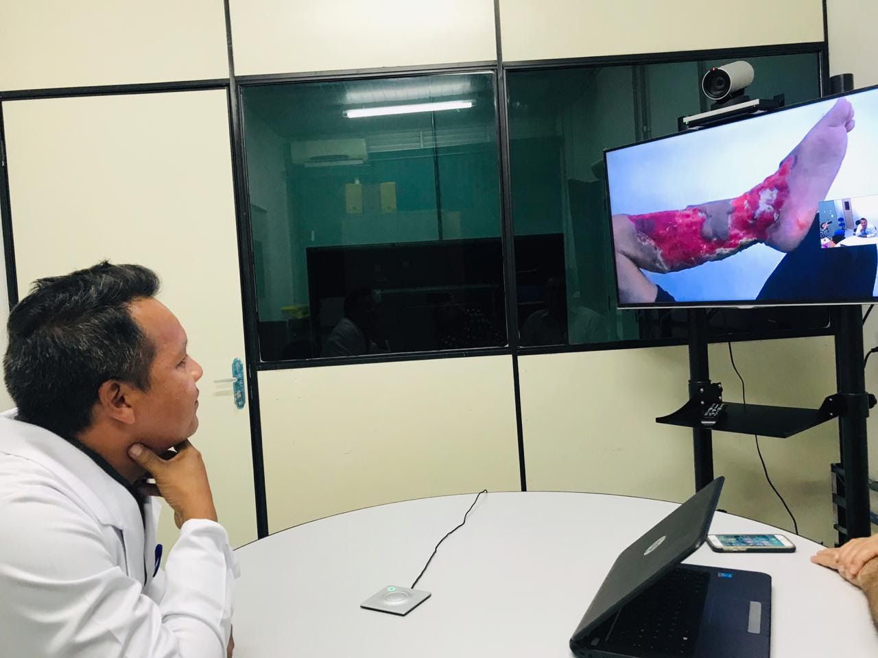 Ufam realiza primeira teleconsulta em neurocirurgia em Humaitá