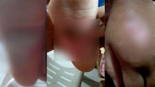 Polícia prende pai por torturar e queimar a filha de 3 anos