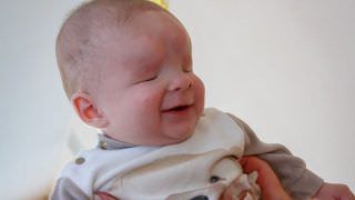 Bebê que nasceu sem olhos é colocado para adoção