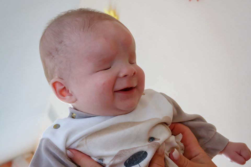 Bebê que nasceu sem olhos é colocado para adoção