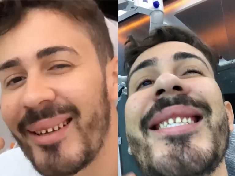 Carlinhos Maia choca a web ao mostrar dentes sem lente de contato