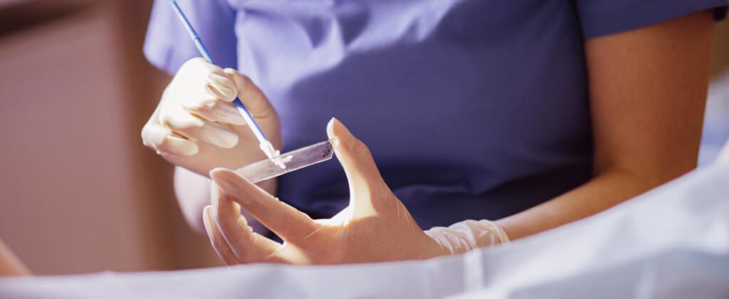 Câncer de colo de útero: exame mais eficaz para diagnóstico será feito no SUS