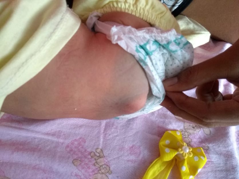'Foi um choque, eu não esperava', diz mãe de bebê que precisa passar por cirurgia urgente