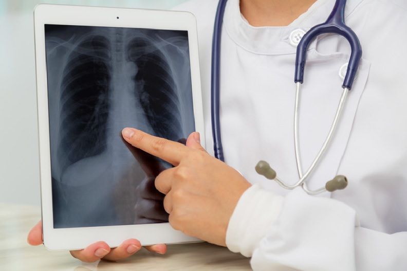 Tuberculose: pandemia reduz avanços no combate à doença, diz especialista