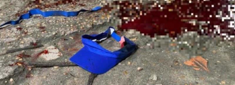 Morre transexual deixada com tiro na cabeça em hospital de Manaus