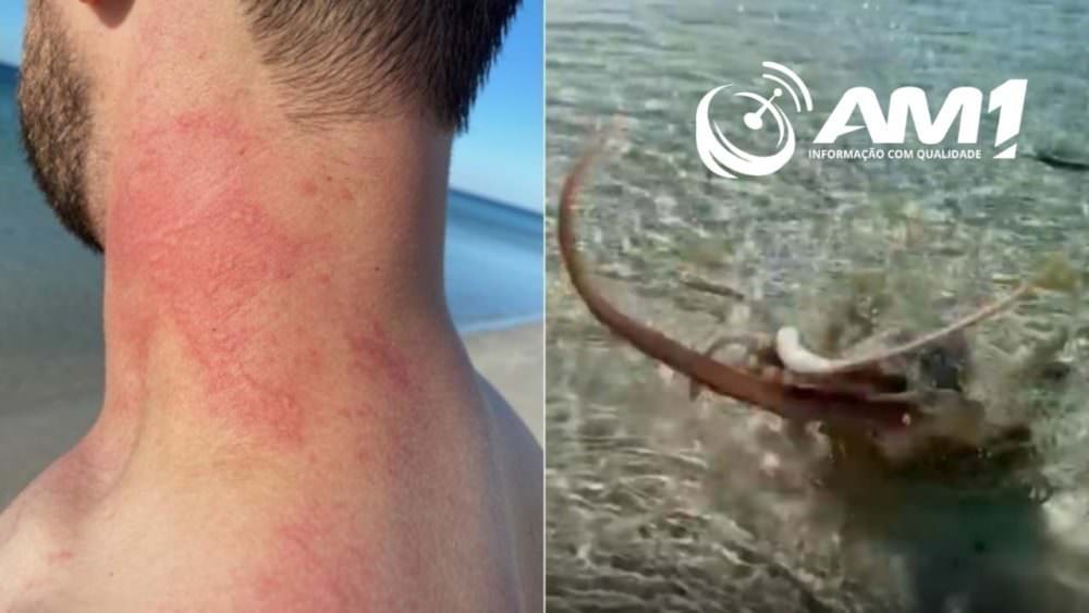 Polvo ataca banhista em praia na Austrália; veja vídeo