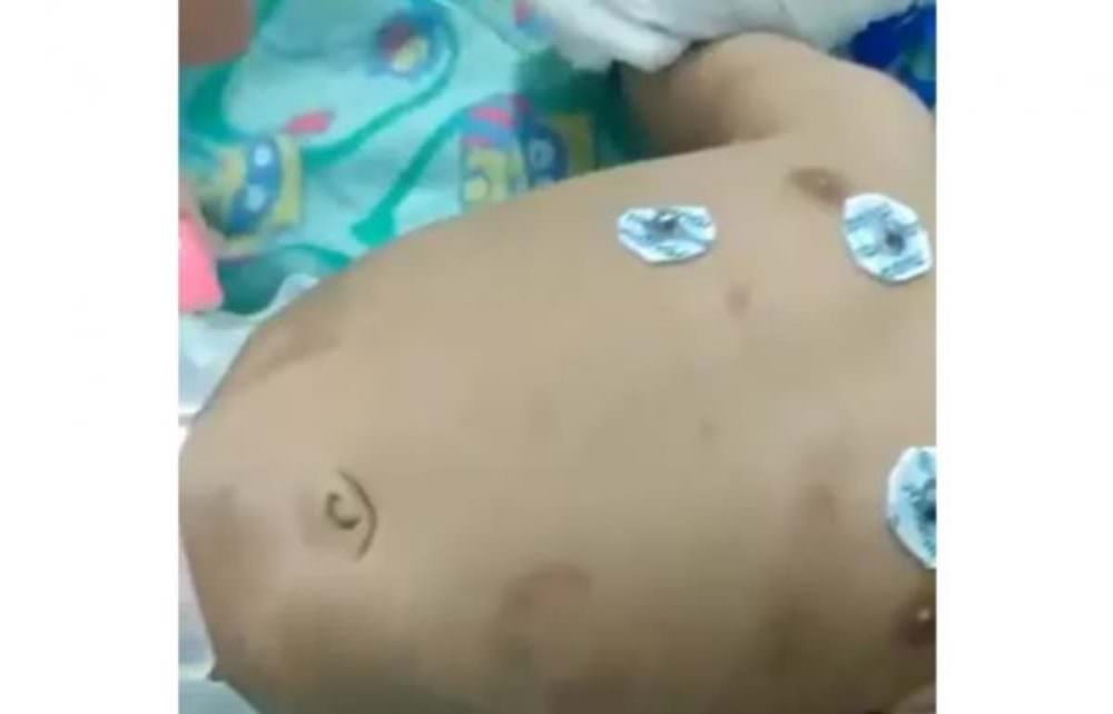 Vídeo: Bebê é internado em estado grave após ser agredido pelo pai porque não parava de chorar