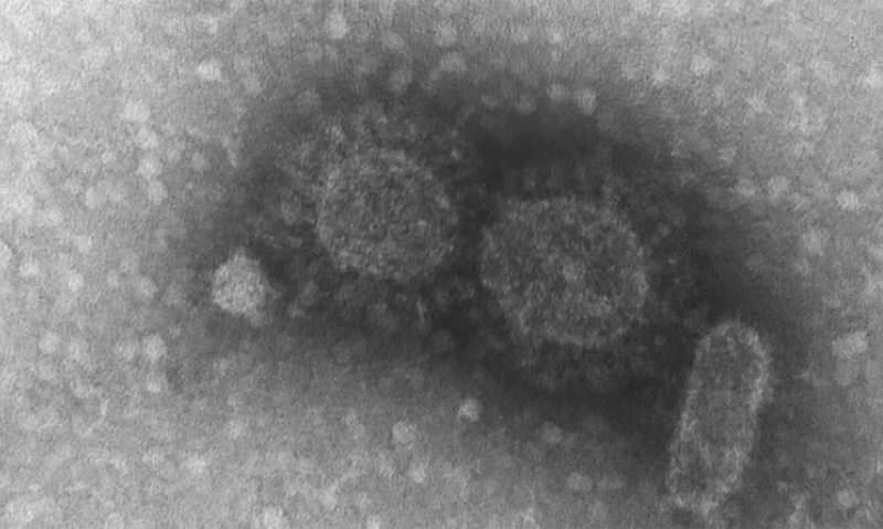SBV confirma nova variante do coronavírus no interior de SP