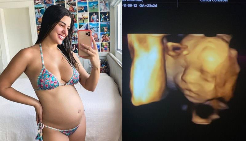Vivian Amorim se emociona ao ver o rosto da filha em ultrassom: ‘eu não aguento’