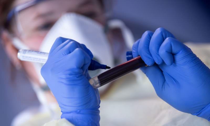 Flurona: AM registra primeiros casos de infecção simultânea por covid e influenza