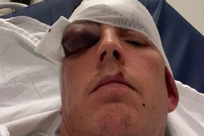 Jogador quase perde a visão após cabeçada em partida de futebol