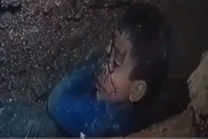 Vídeo: bombeiros tentam resgatar menino de 5 anos preso em poço