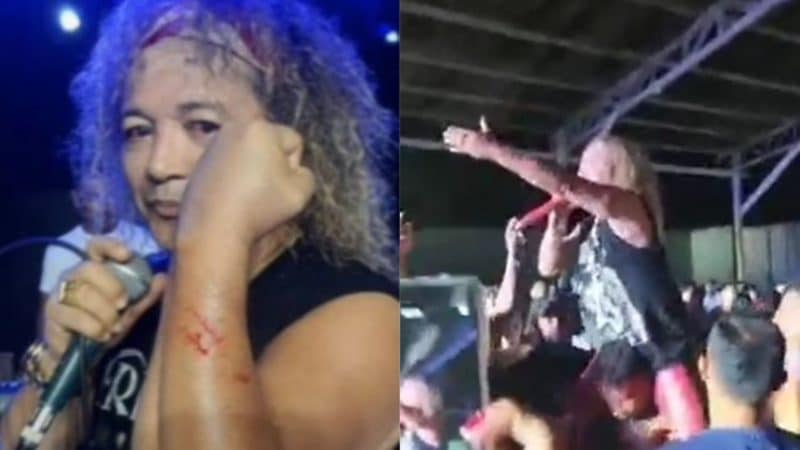 Vídeo: Wanderley Andrade leva ‘dedada’ de fã em show no Pará: ‘sangrou’