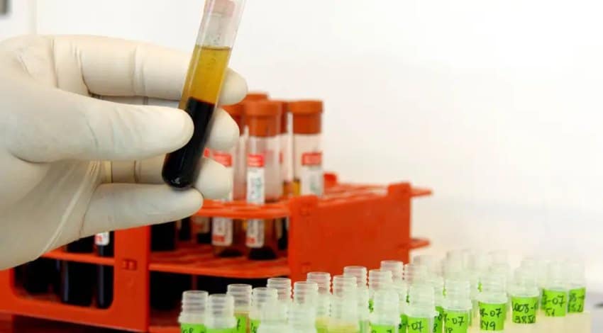 OMS monitora casos de hepatite aguda grave de origem desconhecida