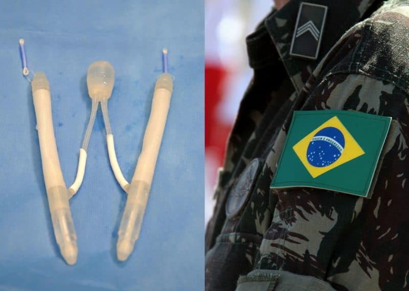 Exército compra R$ 3,5 milhões em próteses penianas e vê nome envolvido em nova polêmica