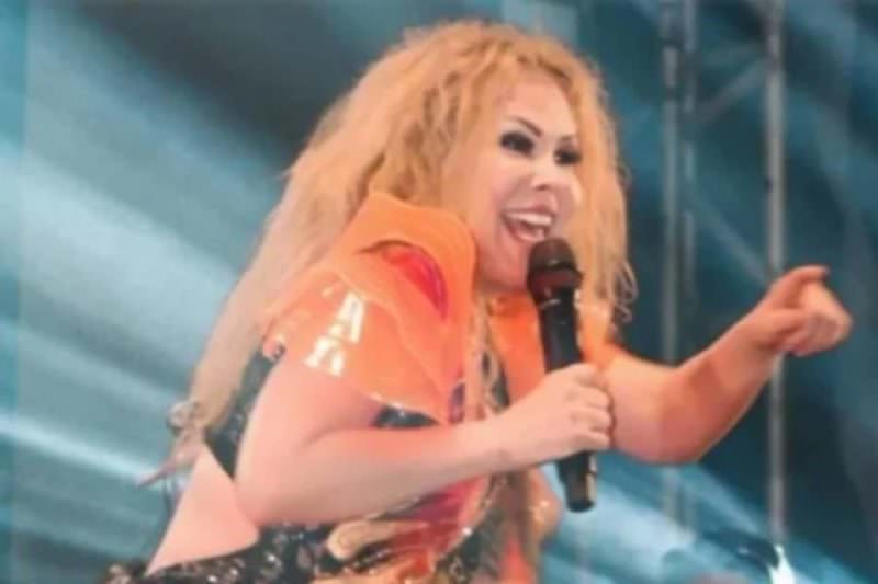 Joelma é internada após inchaço no rosto causado por sequelas da covid